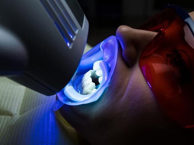 a patient undergoing in-office teeth whitening treatment